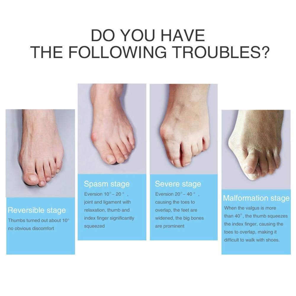 شراب فاصل مصحح إعوجاج اصبع القدم 7 شراب فاصل مصحح إعوجاج اصبع القدم - الصورة 7